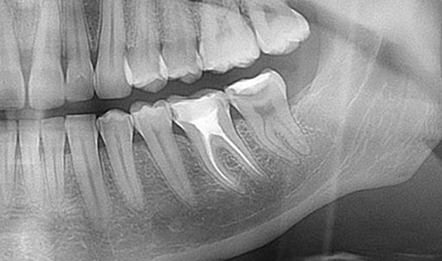 Endodoncie Praha